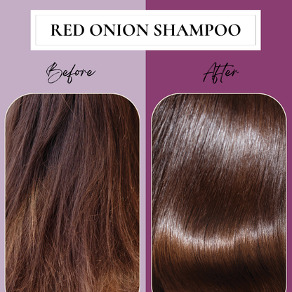 Red Onion & Argan Hair Shampoo for Hair Fall Control infused with Argan Oil – 300 ml